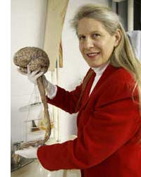 Dr. Jill Bolte Taylor 